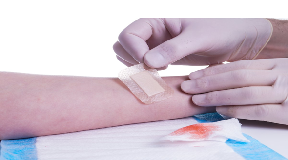 wounds in children