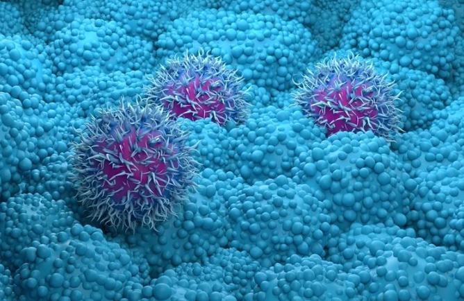 Nuevo modelo facilita la terapia combinada para el cáncer de páncreas
